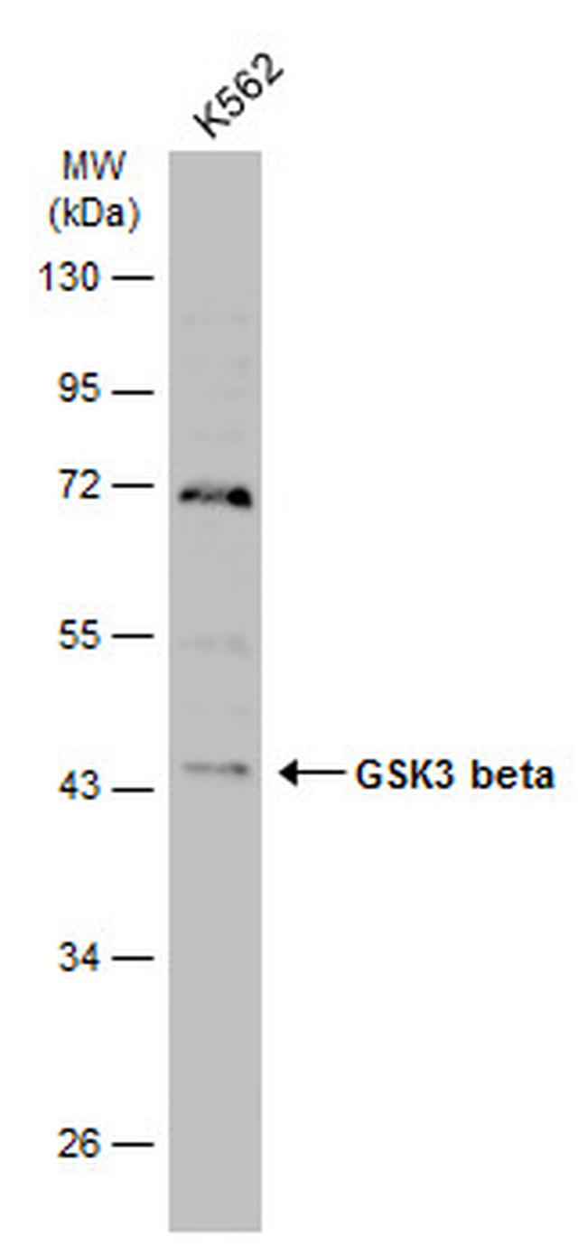 GSK3B Antibody in Western Blot (WB)