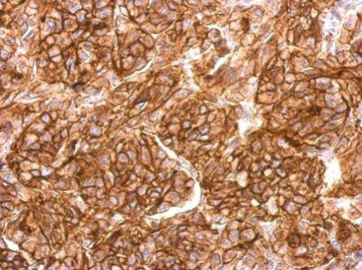 CD10 Antibody in Immunohistochemistry (Paraffin) (IHC (P))