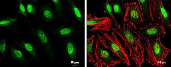 GTF2H1 Antibody in Immunocytochemistry (ICC/IF)