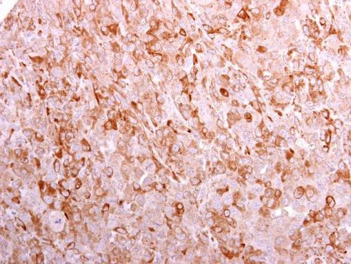 CD3g Antibody in Immunohistochemistry (Paraffin) (IHC (P))