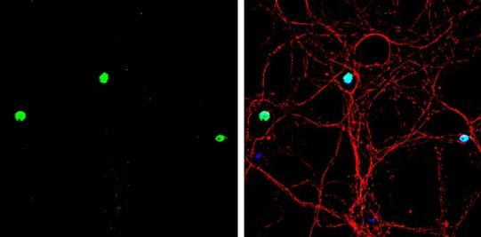 ATOH1 Antibody in Immunocytochemistry (ICC/IF)