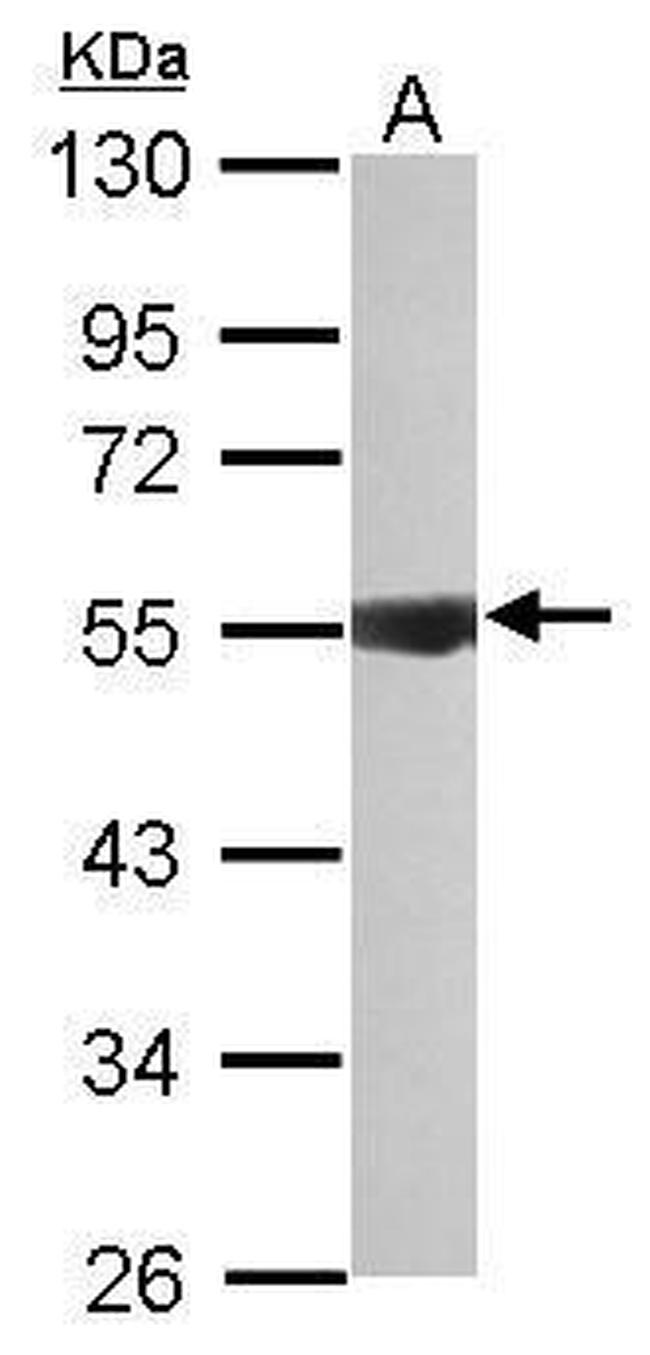 IPPK Antibody in Western Blot (WB)