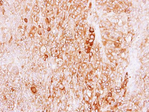 LRGUK Antibody in Immunohistochemistry (Paraffin) (IHC (P))