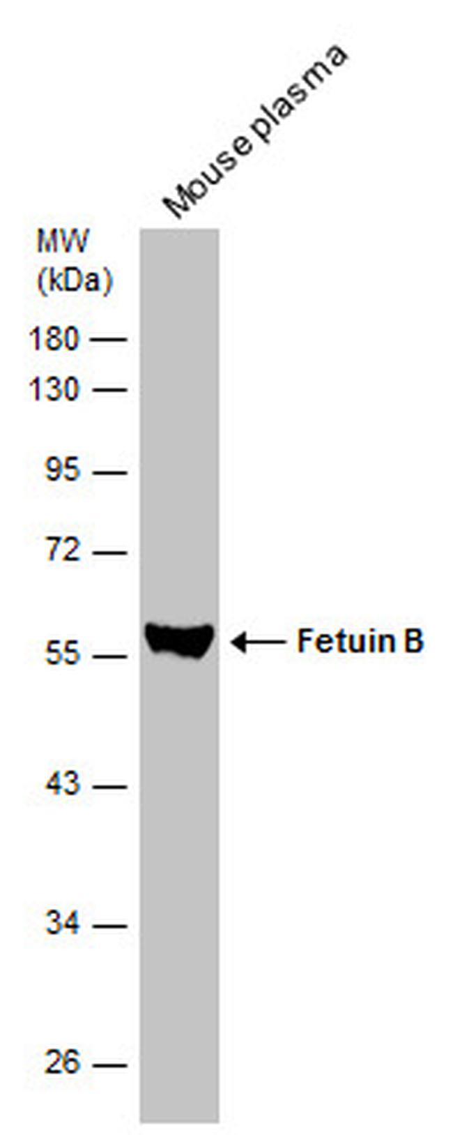 Fetuin B Polyclonal Antibody (PA5-29468)