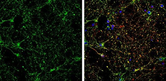 CRMP5 Antibody in Immunocytochemistry (ICC/IF)