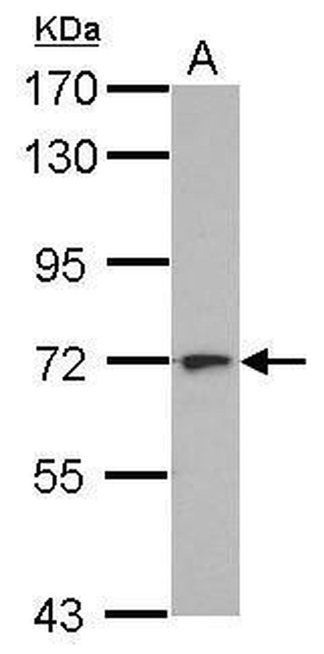 L3MBTL4 Antibody in Western Blot (WB)