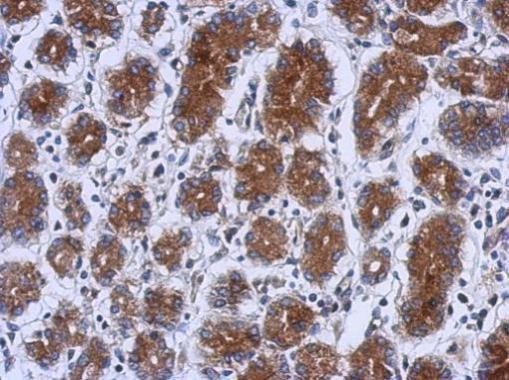 UPF1 Polyclonal Antibody (PA5-29480)