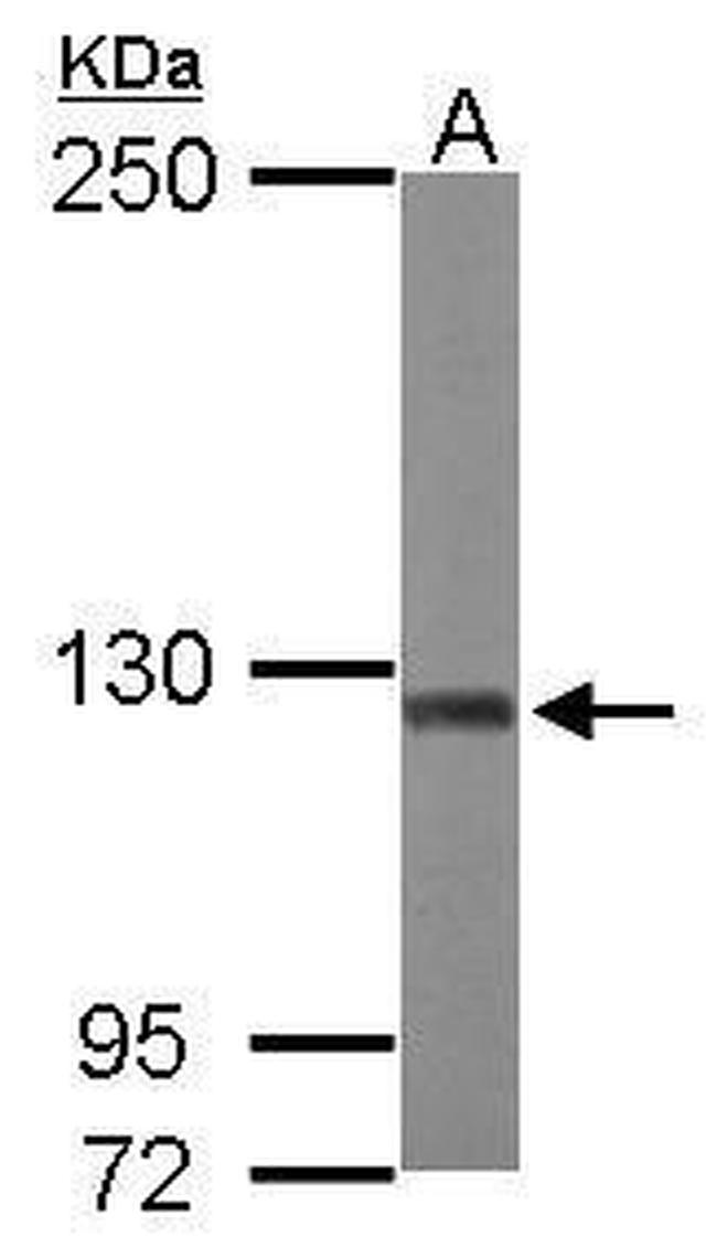 ATP Citrate Lyase Antibody in Western Blot (WB)