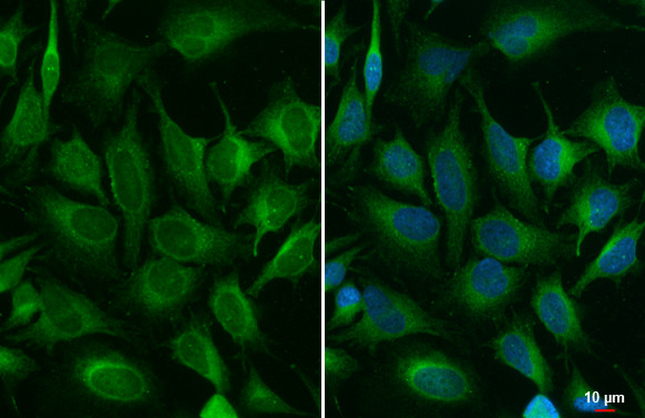 ACSL3 Antibody in Immunocytochemistry (ICC/IF)