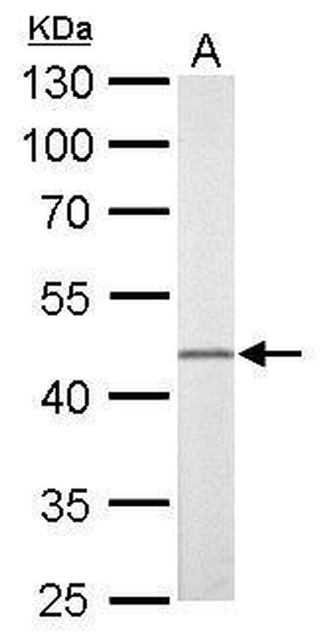 FLI1 Antibody in Western Blot (WB)