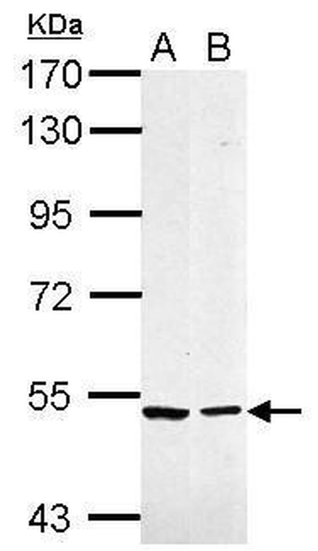 Caspase 10 Antibody in Western Blot (WB)