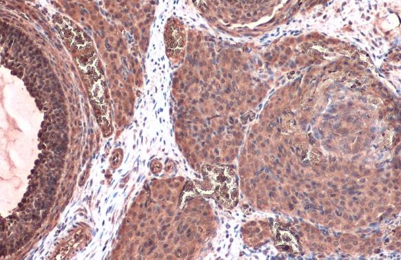 TK1 Antibody in Immunohistochemistry (Paraffin) (IHC (P))