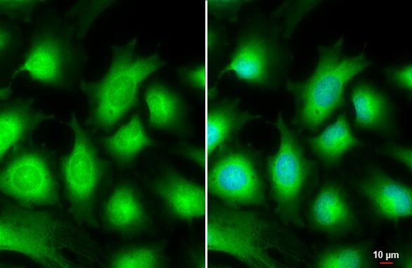 AKT3 Antibody in Immunocytochemistry (ICC/IF)