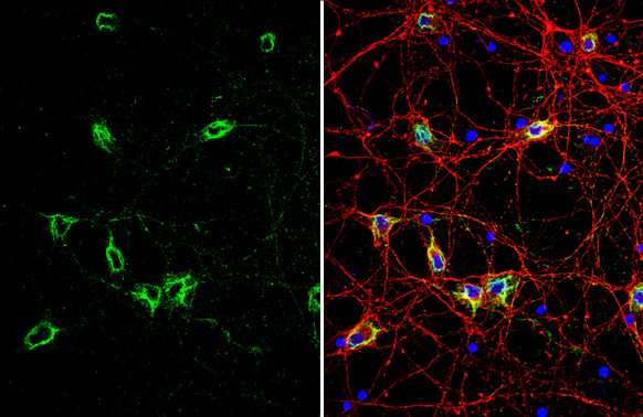 GRP78 Antibody in Immunocytochemistry (ICC/IF)