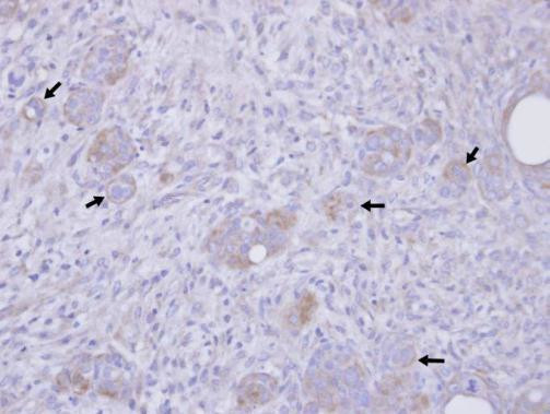 Stathmin 1 Antibody in Immunohistochemistry (Paraffin) (IHC (P))