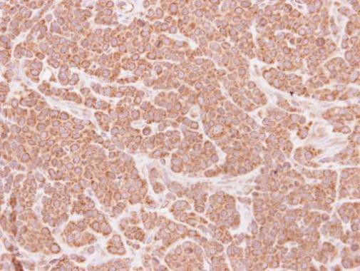 DAP3 Antibody in Immunohistochemistry (Paraffin) (IHC (P))