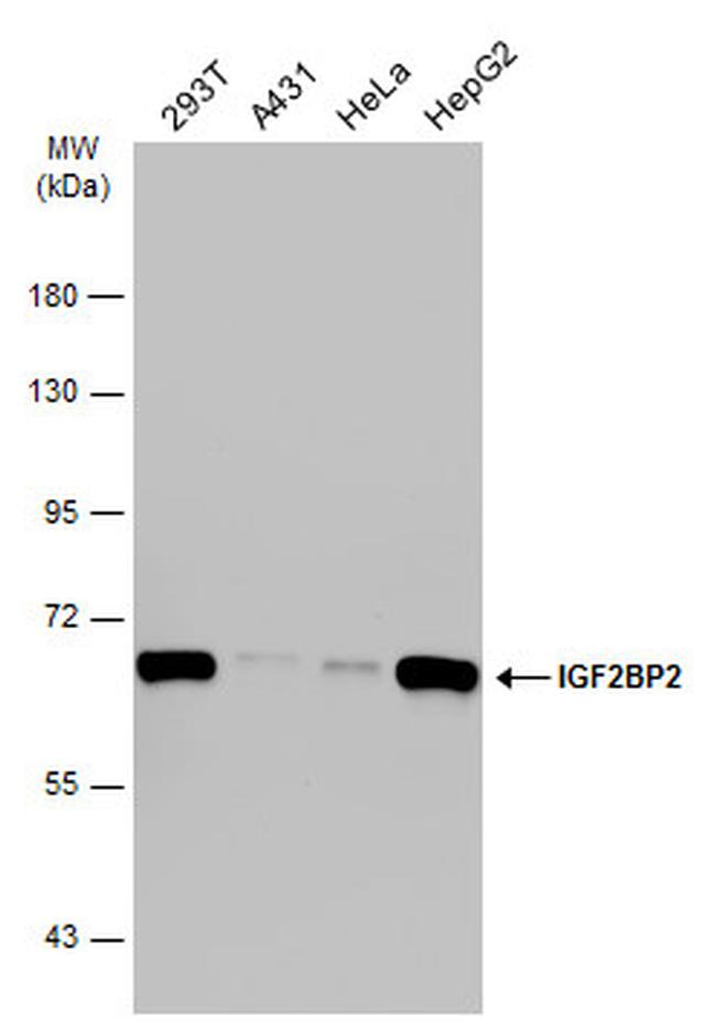 IGF2BP2 Antibody in Western Blot (WB)