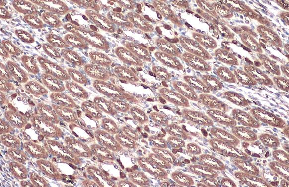 V-ATPase E1 Antibody in Immunohistochemistry (Paraffin) (IHC (P))