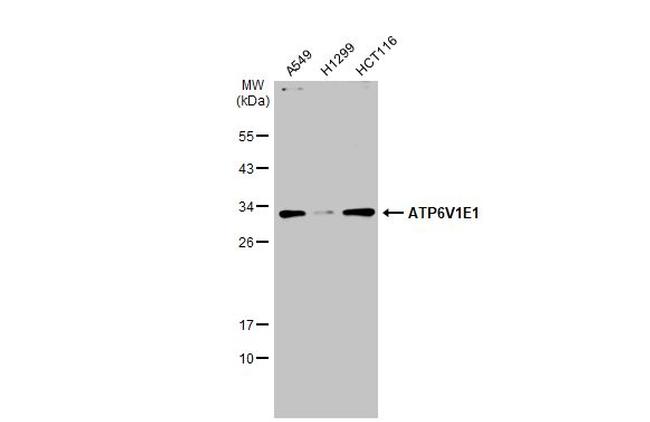 V-ATPase E1 Antibody in Western Blot (WB)