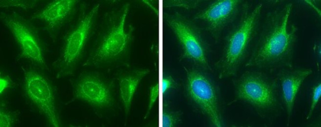 V-ATPase E1 Antibody in Immunocytochemistry (ICC/IF)