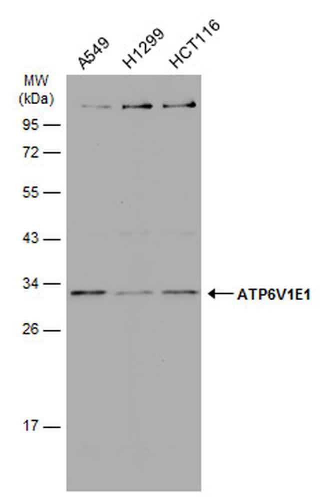 V-ATPase E1 Antibody in Western Blot (WB)