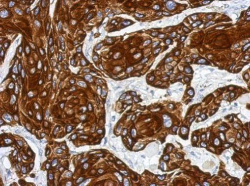 Cytokeratin 17 Antibody in Immunohistochemistry (Paraffin) (IHC (P))