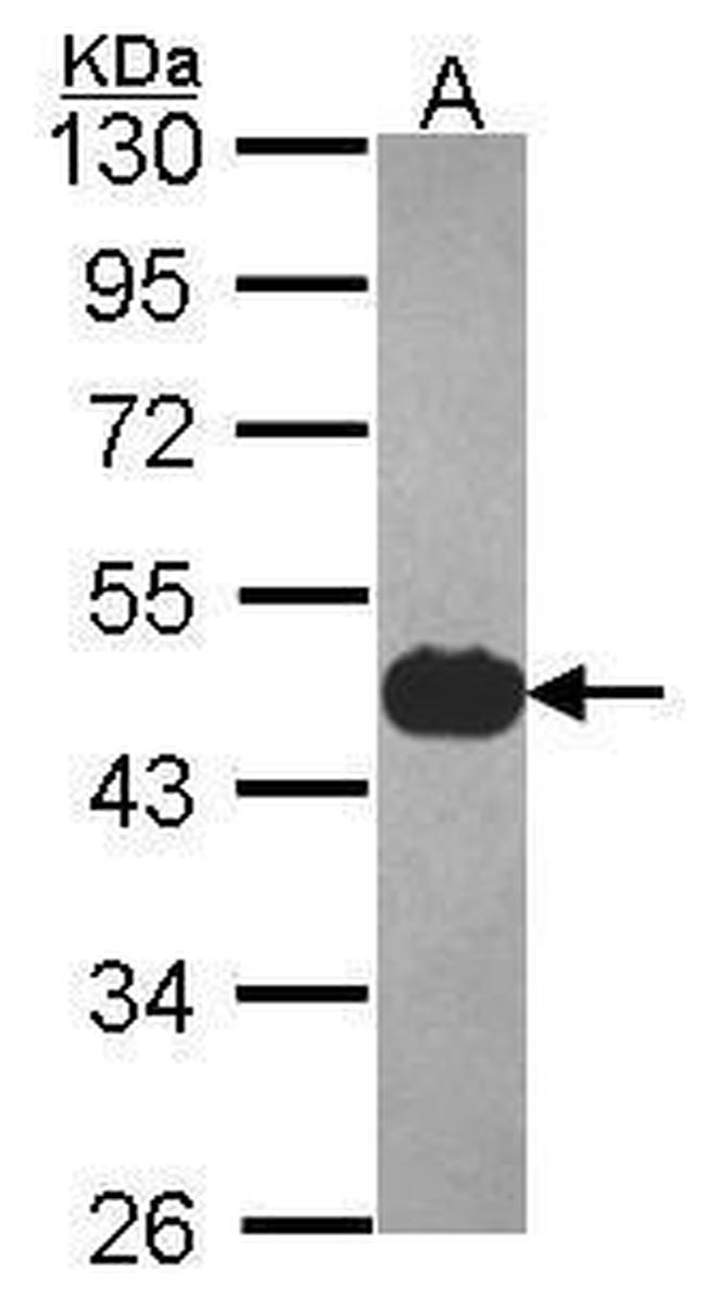 Cytokeratin 17 Antibody in Western Blot (WB)