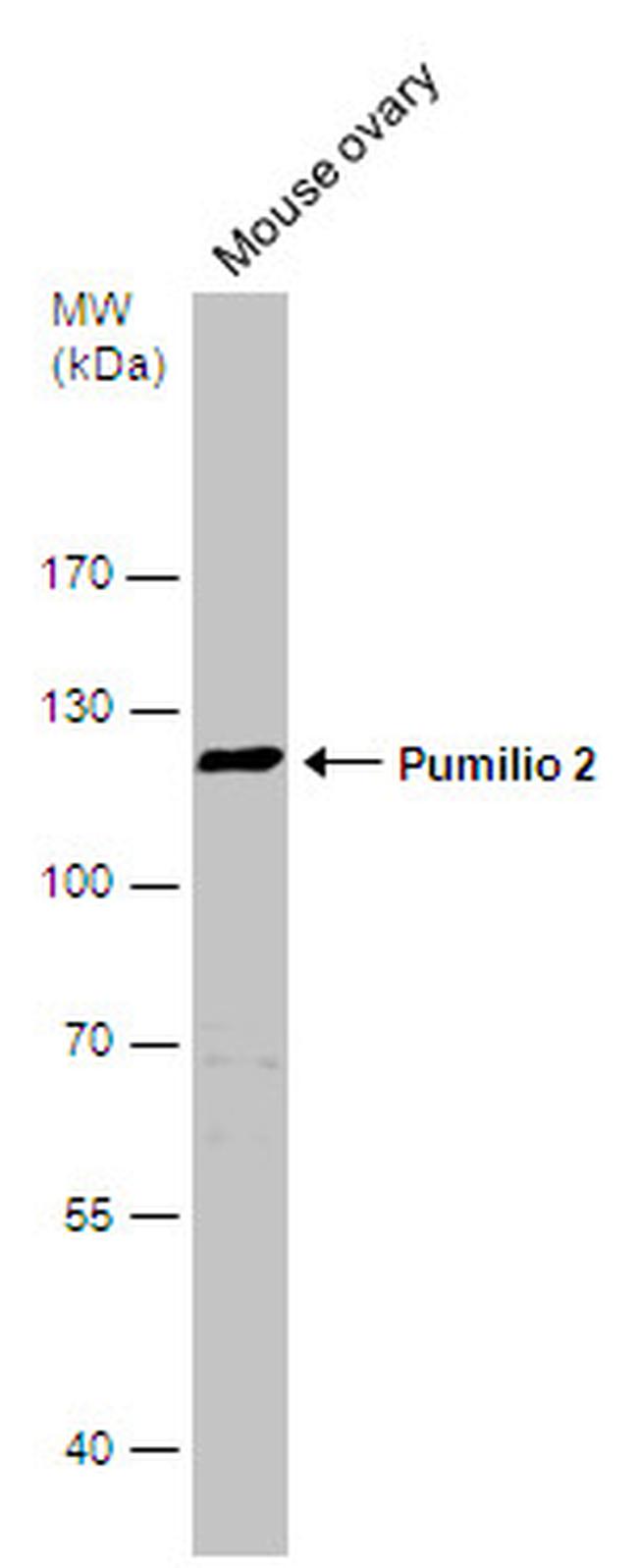PUM2 Antibody in Western Blot (WB)