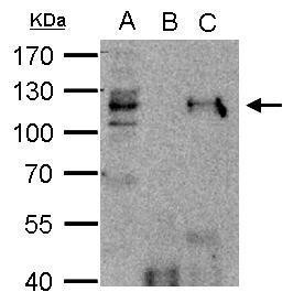 HDAC7 Antibody in Immunoprecipitation (IP)