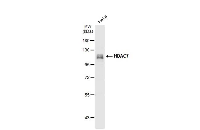 HDAC7 Antibody in Western Blot (WB)