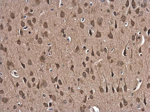 GSR Antibody in Immunohistochemistry (Paraffin) (IHC (P))