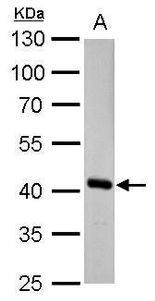 FAH Antibody in Western Blot (WB)