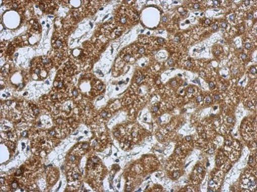 HSD17B3 Antibody in Immunohistochemistry (Paraffin) (IHC (P))