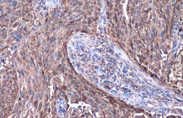 SERPINB3 Antibody in Immunohistochemistry (Paraffin) (IHC (P))