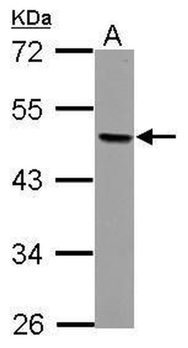 AP2 beta Antibody in Western Blot (WB)