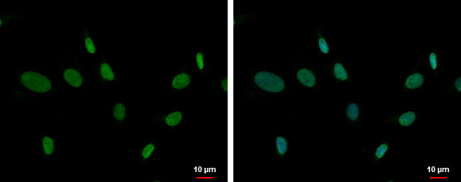 ZNF74 Antibody in Immunocytochemistry (ICC/IF)