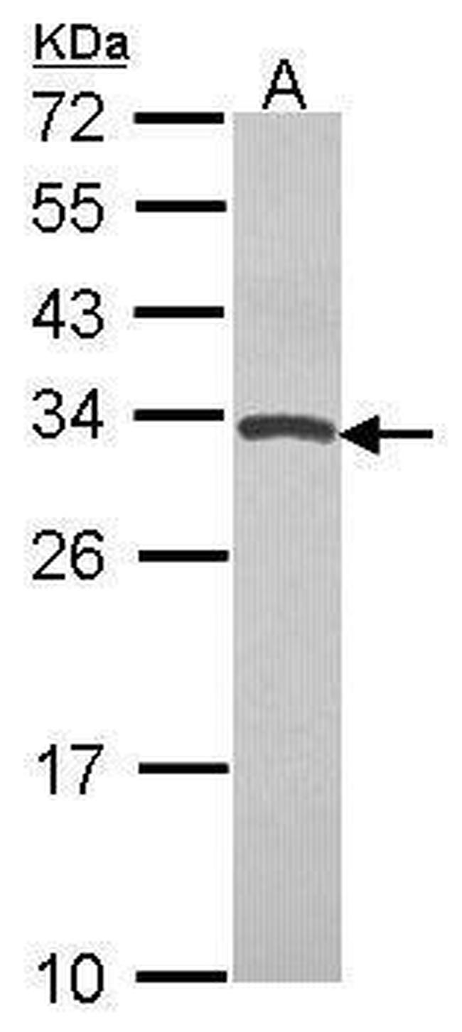 TIMP4 Antibody in Western Blot (WB)