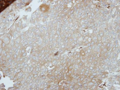 LIMS1 Antibody in Immunohistochemistry (Paraffin) (IHC (P))