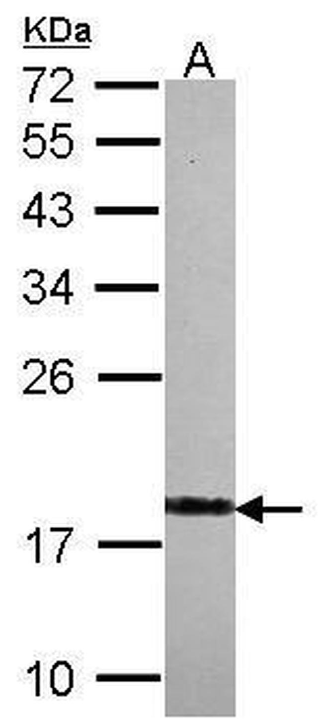 VSNL1 Antibody in Western Blot (WB)