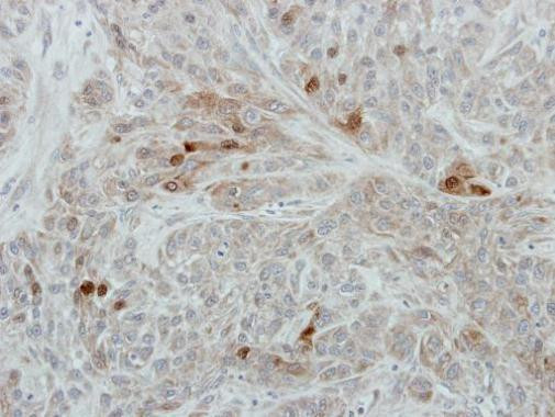 RANBP3 Antibody in Immunohistochemistry (Paraffin) (IHC (P))