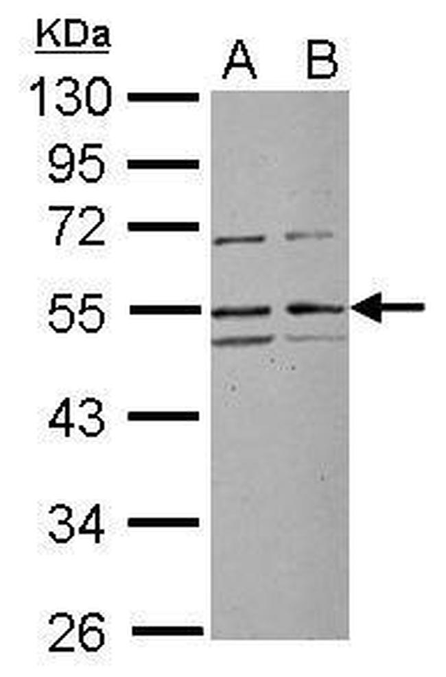 RRP1 Antibody in Western Blot (WB)