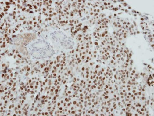 MTA2 Antibody in Immunohistochemistry (Paraffin) (IHC (P))