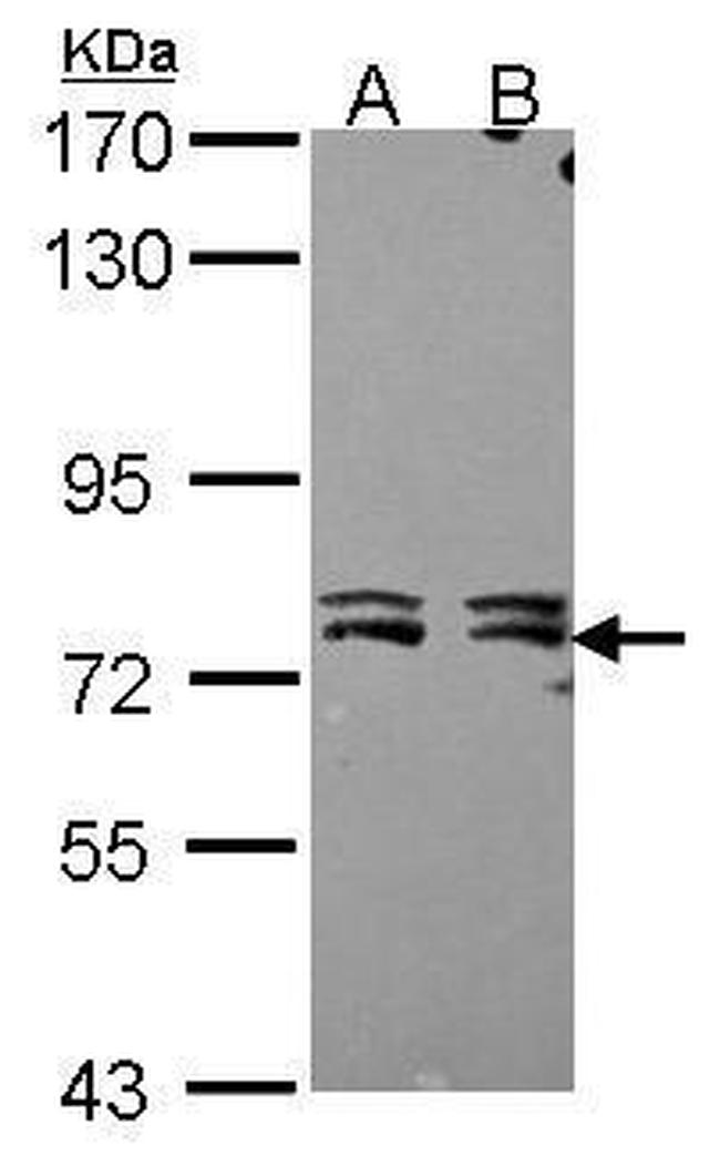 MTA2 Antibody in Western Blot (WB)