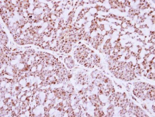 IRF9 Antibody in Immunohistochemistry (Paraffin) (IHC (P))