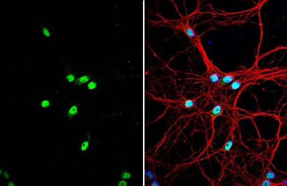 SAM68 Antibody in Immunocytochemistry (ICC/IF)