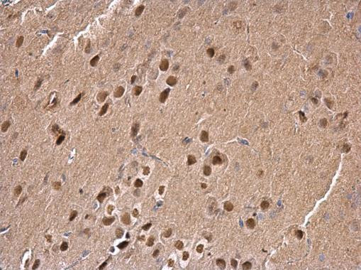 SAM68 Antibody in Immunohistochemistry (Paraffin) (IHC (P))