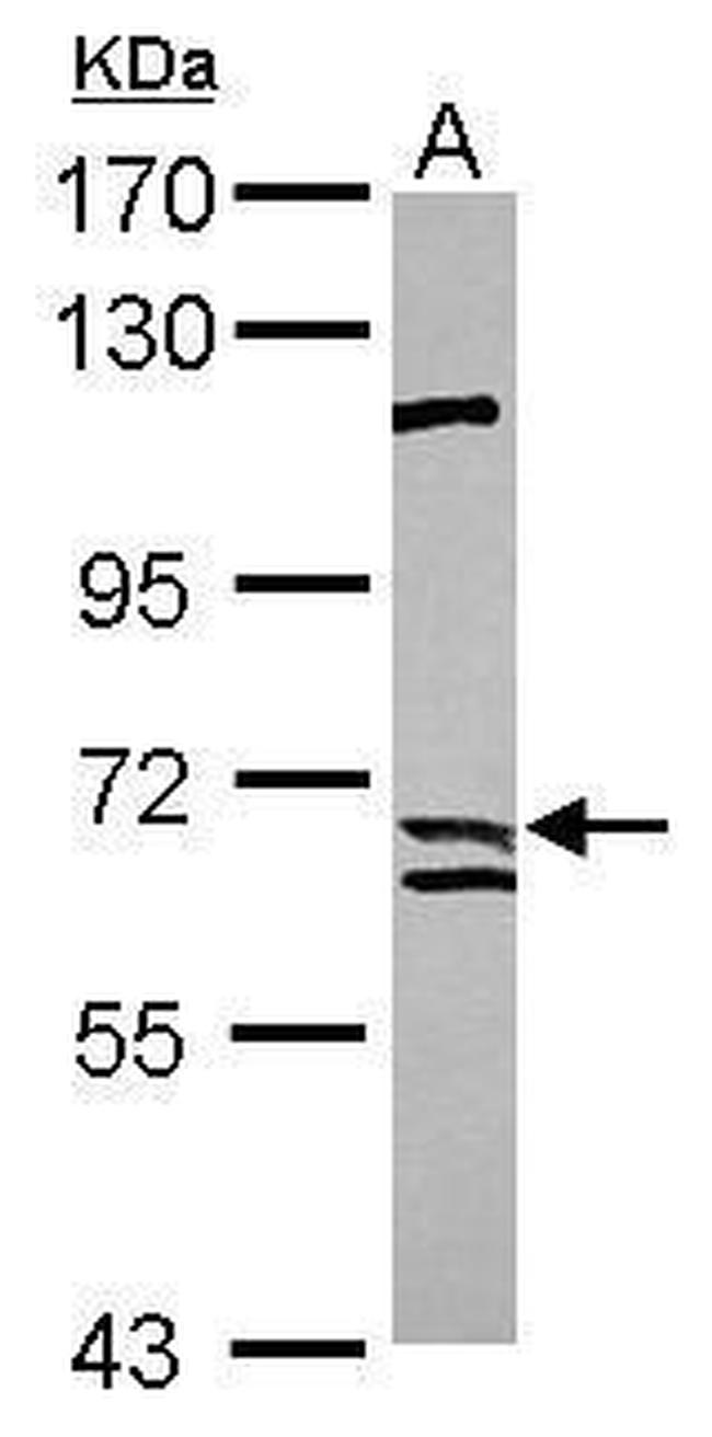 Calpain 9 Antibody in Western Blot (WB)