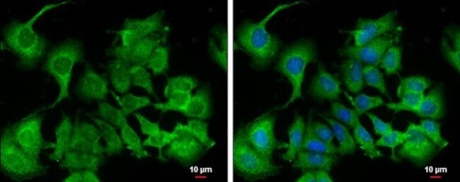 Calpain 9 Antibody in Immunocytochemistry (ICC/IF)