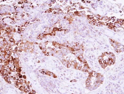 MAPRE3 Antibody in Immunohistochemistry (Paraffin) (IHC (P))