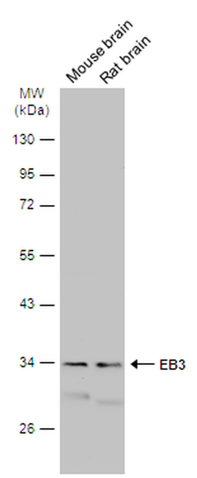 MAPRE3 Antibody in Western Blot (WB)